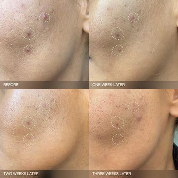 Faded Brightening Serum for Dark Spots and Discoloration (UNSCENTED)